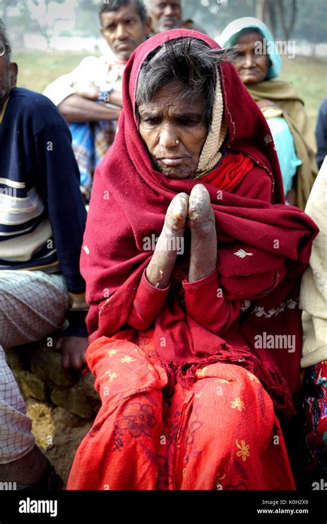 Lepers In A Colony In Rural India Stock Photo Alamy