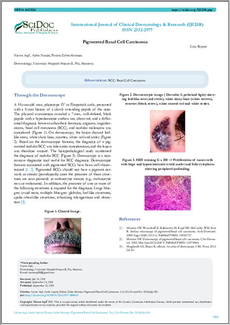 Pdf Pigmented Basal Cell Carcinoma International Journal Of