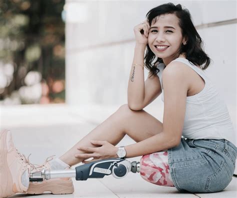 Amputee Model In Spore Wishes To Spread Positivity