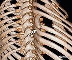 肋骨外傷丨影像表現、併發症 - 每日頭條