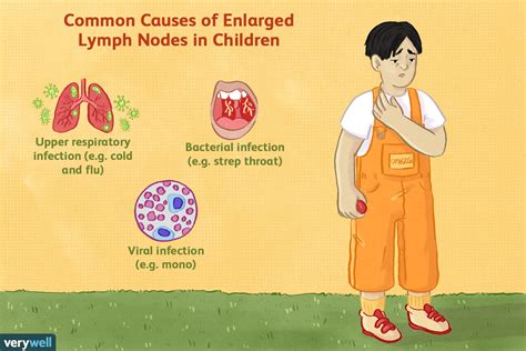 Swollen Glands And Lymphadenopathy In Children