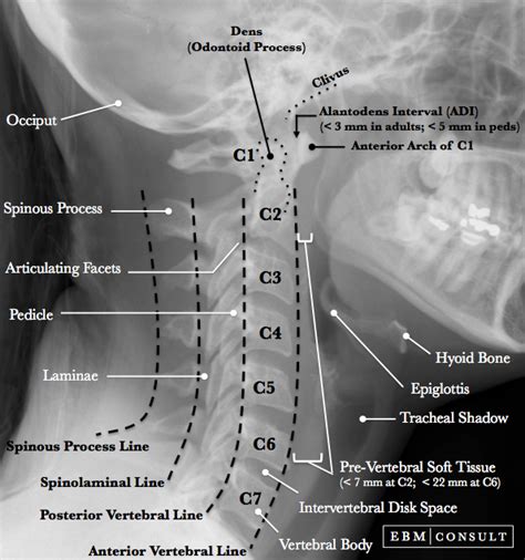 Ap Neck Radiograph X Ray In 2022 Radiology Student Radiology