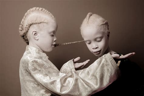 Albino Twins From Brazil Are Challenging The Fashion