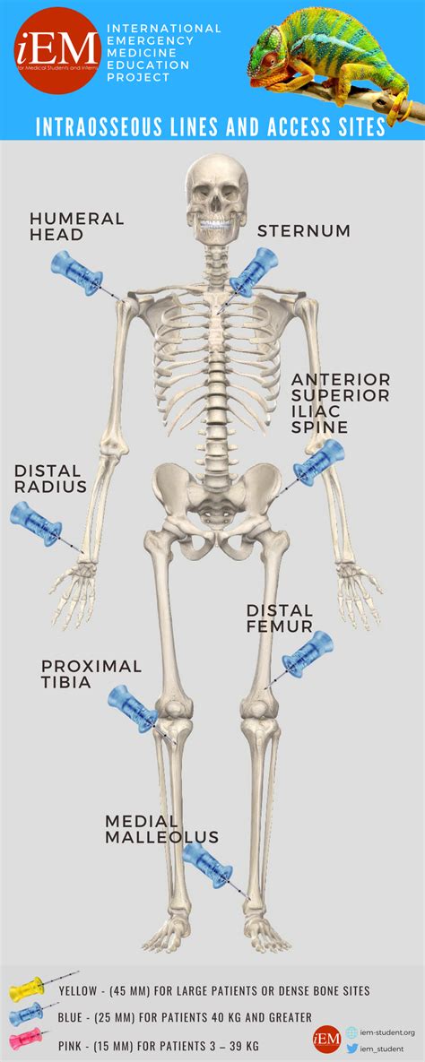 Intraosseous Line Access Sites International Emergency Medicine