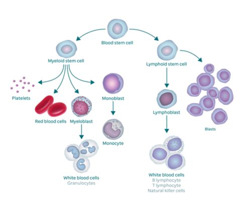 Acute lymphoblastic leukaemia (all) is a malignant transformation of a clone of cells from lymphoid progenitor cells. Acute Lymphoblastic Leukemia (ALL) in Children and Teens ...