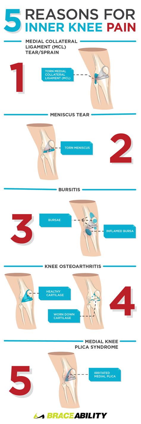 Pin on Knee Pain
