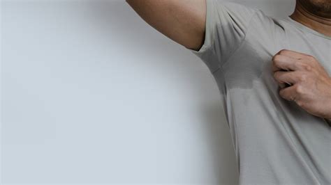 Hyperhidrosis Toronto Excess Local Sweating Treatment Clinic