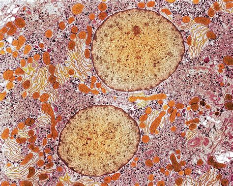 Liver Cell Photograph By Medimagescience Photo Library Fine Art America