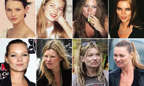 Kate Moss The Effect Of 20 Years Of Drink Drugs And Partying Daily