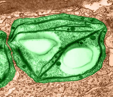 Amyloplast's primary functions are the degradation and synthesis of starch. Chara Amyloplast (TEM) - Stock Image - C009/4050 - Science ...