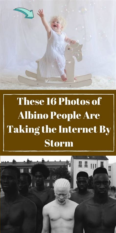 These Photos Of Albino People Are Taking The Internet By Storm Albino People Photo Sessions