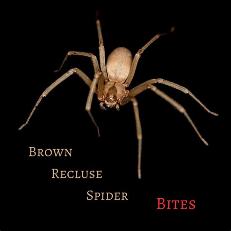 Brown Recluse Bite Pictures Stages Signs Treatment YouMeMindBody