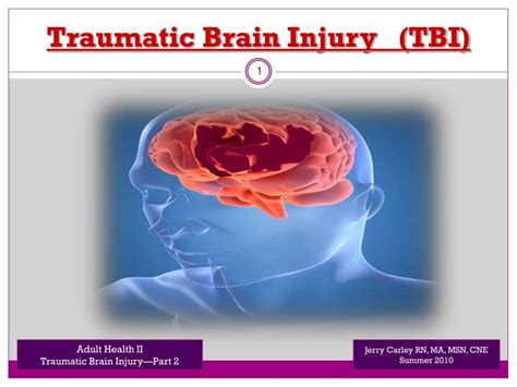 Ppt Traumatic Brain Injury Tbi Powerpoint Presentation Free
