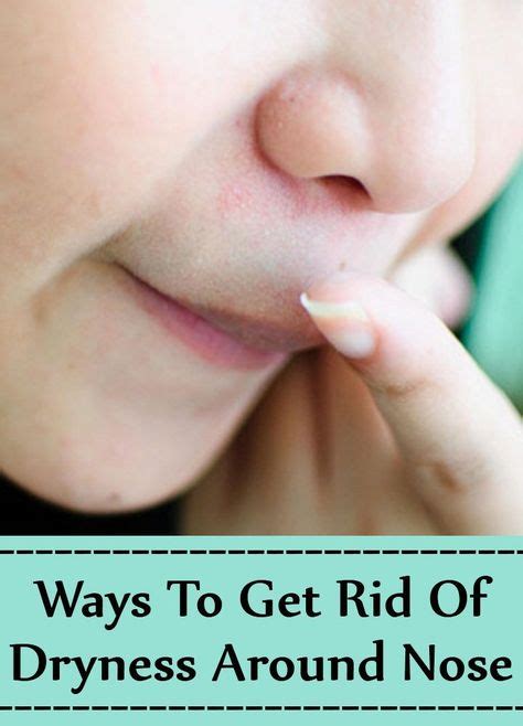 8 Ways To Get Rid Of Dryness Around Nose In 2019 Dry Nose Skin Nose