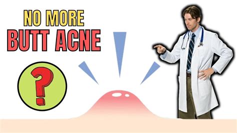 How To Get Rid Of Butt Acne Naturally Fast And Quick Youtube