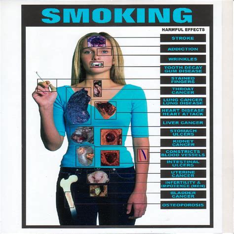 Health Effects Of Smoking Wiki Cigarette Smoking After Effects Quit Smoking Tips