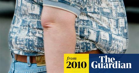 Call For More Obesity Surgery To Cut Benefits And Nhs Bills Obesity