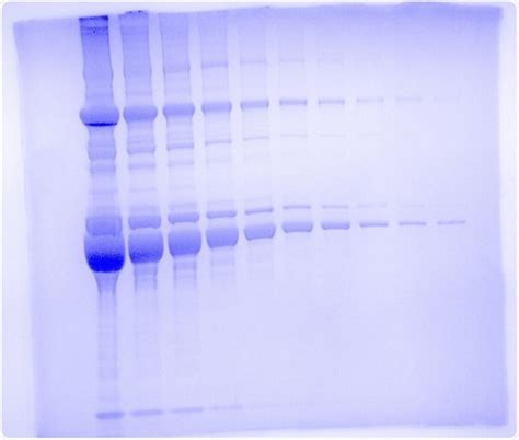 12 Polyacrylamide Gel Recipe Besto Blog