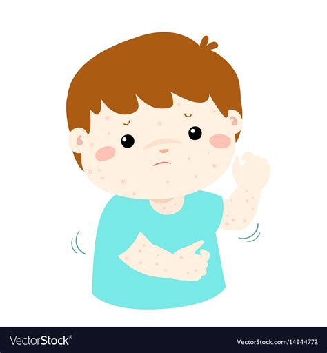 Boy Scratching Itching Rash On His Body Royalty Free Vector