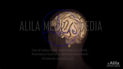 Alila Medical Media Parties Du Cerveau Et Du Tronc Cérébral