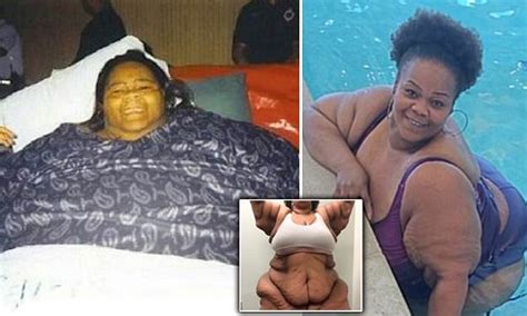 World S Fattest Woman Who Was Bed Bound For Five Years Sheds Lbs Daily Mail Online