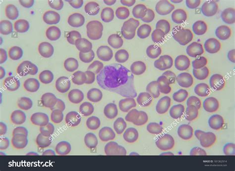 Blood Smear Monocyte Shoot By Dslr Under Microscope X Stock Photo My