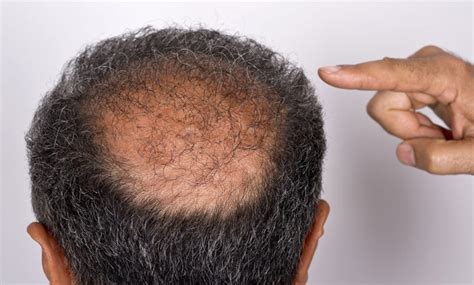 Is There Such A Thing As Natural Black Hair - Natural Hair Color