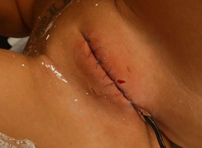 See And Save As The Beauty Of Pussy Modification Porn Pict 4crot