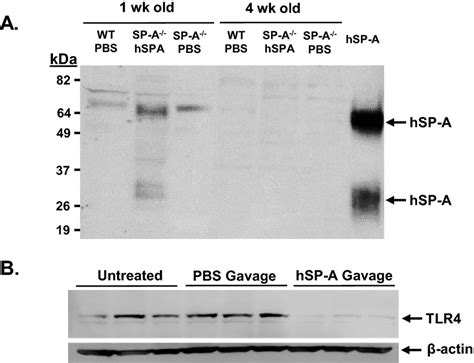 Impact Of Orogastric Gavage Of Neonatal Sp A−− Mice With Purified