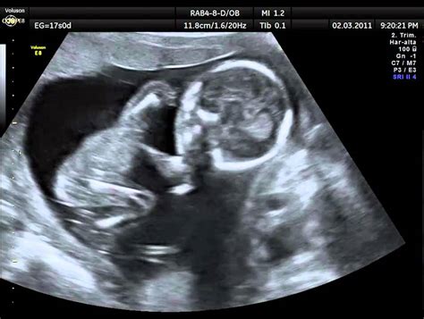 Simple Science: How to Make a Volcano with Kids