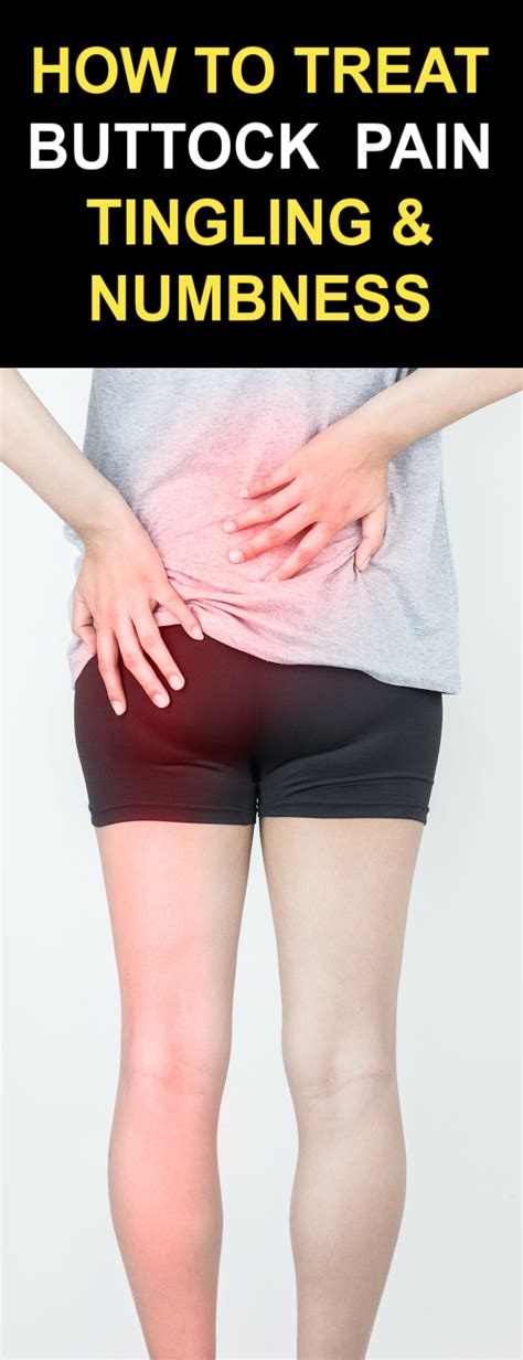 Pin On Buttock Pain