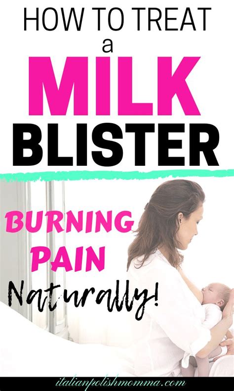 7 Effective Ways To Treat Milk Blisters And Thrush Naturally Milk