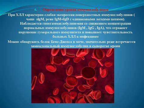 Хронический лимфолейкоз - презентация онлайн Картинка - Хронический лимфолейкоз - презентация онлайн
