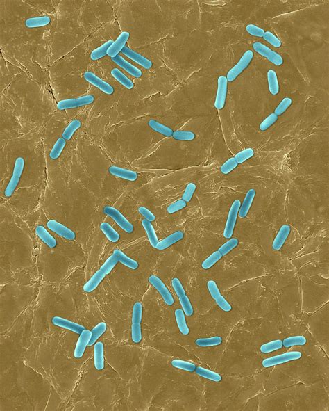 E Coli On Human Skin Surface Photograph By Dennis Kunkel Microscopy