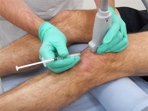 Hgh (büyüme hormonu) doping testinde çıkarmı? Osteoarthritic knees | How can steroid injections help ...