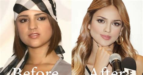 The new tucson becomes a family van; Celebrity Before & After Plastic Surgery: Eiza Gonzalez ...