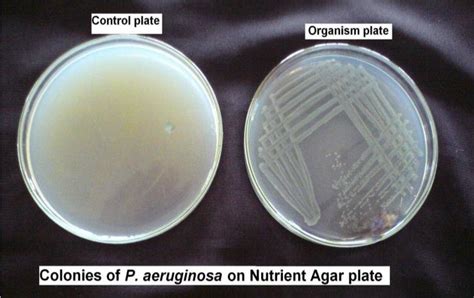 Colonies Of Pseudomonas Aeruginosa On Nutrient Agar Plate