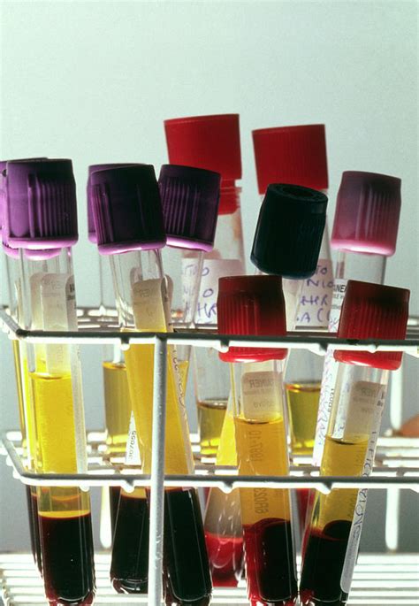 Centrifuged Blood Samples In Test Tubes Photograph By Klaus