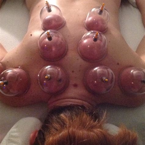 Have You Tried Massage Cupping This Ancient Treatment Is Making A Modern Health Debut St