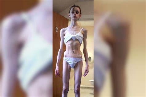Increíble Transformación De La Anorexia A Ser Luchadora De Artes