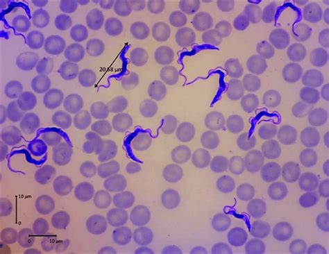 Morphology Of Trypanosoma Evansi With Giemsa Staining Viewed Under A