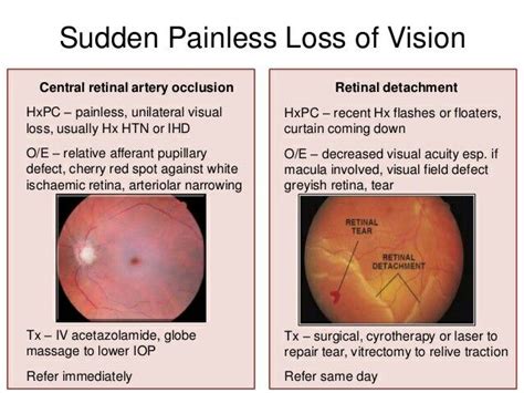 Sudden Painless Loss Of Vision Also Viterous Haemorrhage