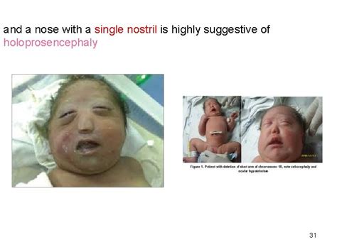 Physical Examination Of Newborn By Dr Behzad Barekatain