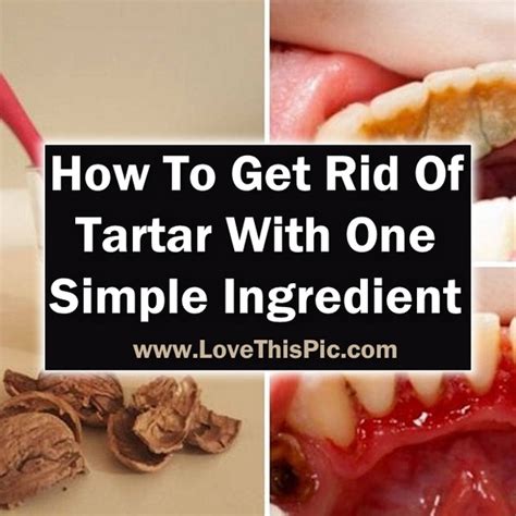 here is how to get rid of tartar with only one simple ingredient