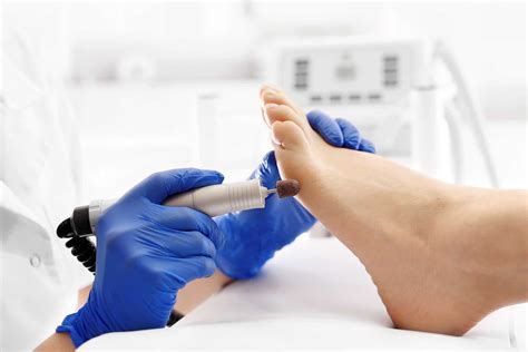 What Is Chiropody Blackberry Clinic Services