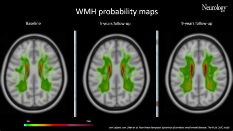 Cerebral Small Vessel