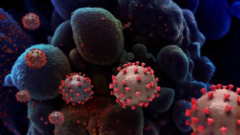 Nicknamed the double mutant variant by the bbc and others, the variant is sparking concern among some scientists because it contains not just one, but two worrisome mutations in its genetic. 'Double mutant' coronavirus variant is found in California