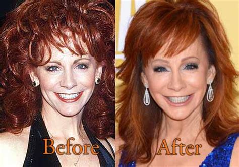 reba mcentire plastic surgery before and after pictures