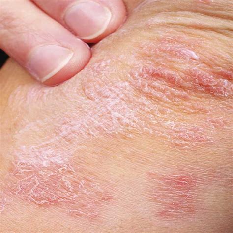Skin Problems Can Be Sorted When You Know What They Are
