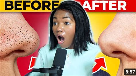1 Product To Remove Blackheads Instantly Youtube